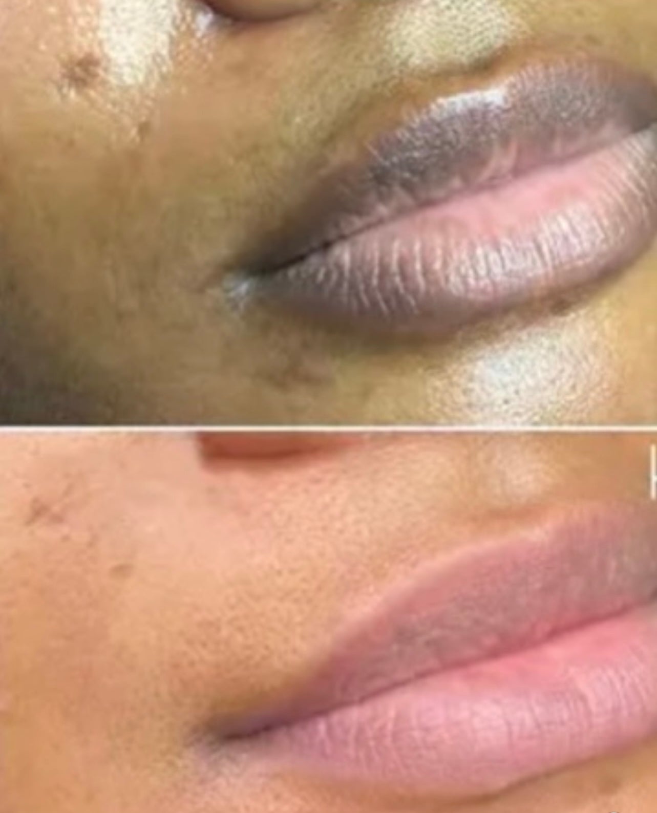 Lightening/Lip Scrub